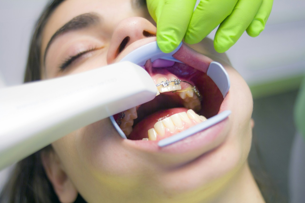 dental treatment